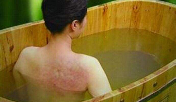 男性胸部牛皮癣的症状有哪些